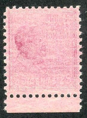 US 829 Error LH Underinked